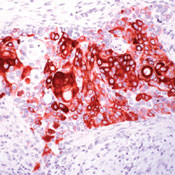 Cytokeratin 14 Antibody in Immunohistochemistry (Paraffin) (IHC (P))