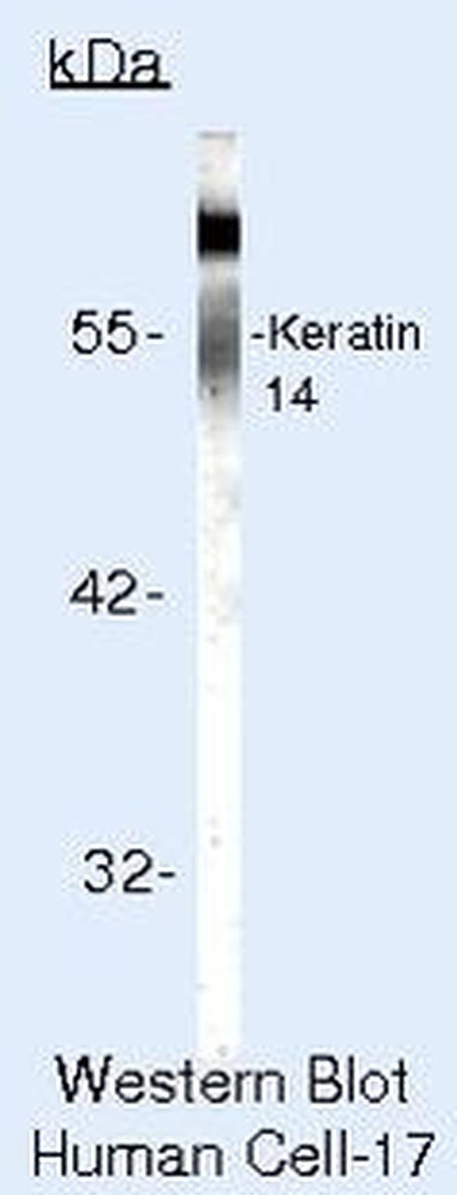 Cytokeratin 14 Antibody in Western Blot (WB)