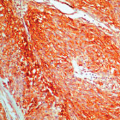 c-Kit Antibody in Immunohistochemistry (Paraffin) (IHC (P))