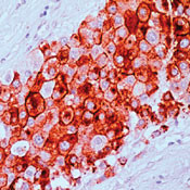 MUC1 Antibody in Immunohistochemistry (Paraffin) (IHC (P))