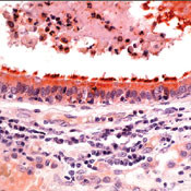 beta Tubulin Antibody in Immunohistochemistry (Paraffin) (IHC (P))