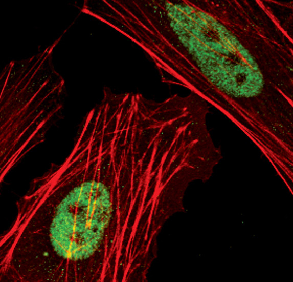 SKP2 Antibody in Immunocytochemistry (ICC/IF)