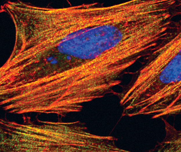 MYH9 Antibody in Immunocytochemistry (ICC/IF)