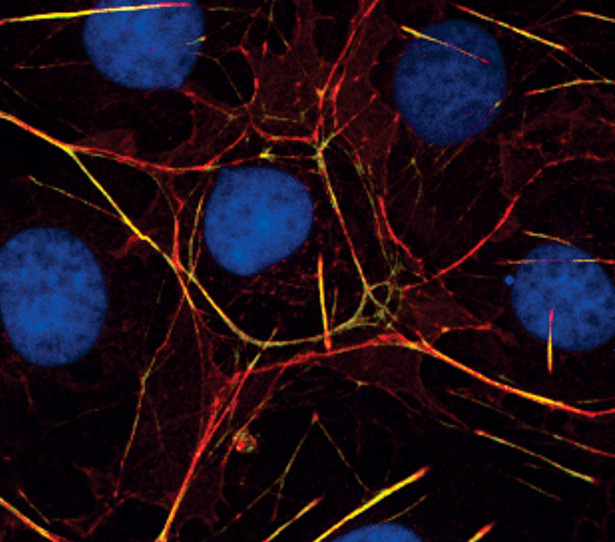 MYH10 Antibody in Immunocytochemistry (ICC/IF)