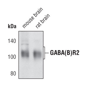 GABBR2 Antibody in Western Blot (WB)