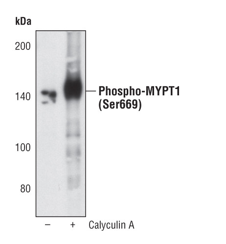 Phospho-MYPT1 (Ser668) Antibody in Western Blot (WB)