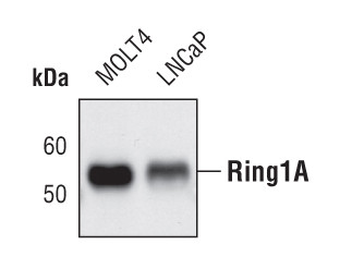 RING1 Antibody in Western Blot (WB)