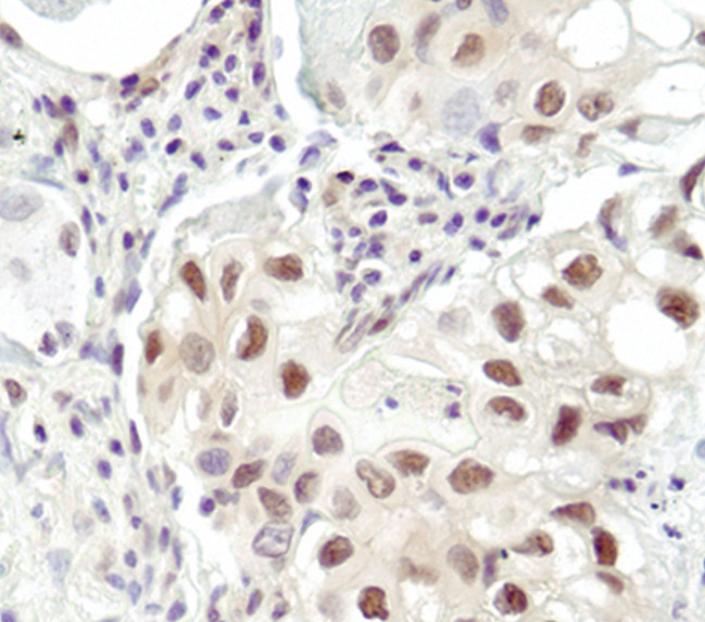 Ubiquitin Antibody in Immunohistochemistry (IHC)