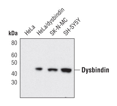 DTNBP1 Antibody in Western Blot (WB)