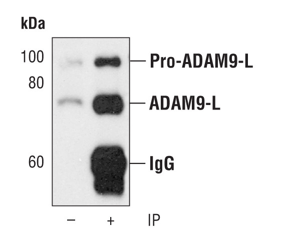 ADAM9 Antibody in Immunoprecipitation (IP)