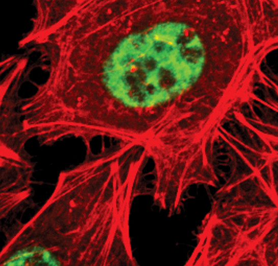 Phospho-SRC3 (Thr24) Antibody in Immunocytochemistry (ICC/IF)