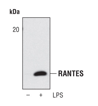 CCL5 (RANTES) Antibody in Western Blot (WB)