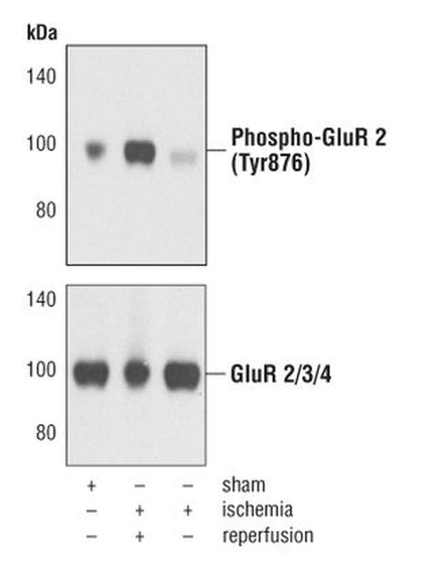 Phospho-GluR2 (Tyr876) Antibody in Western Blot (WB)