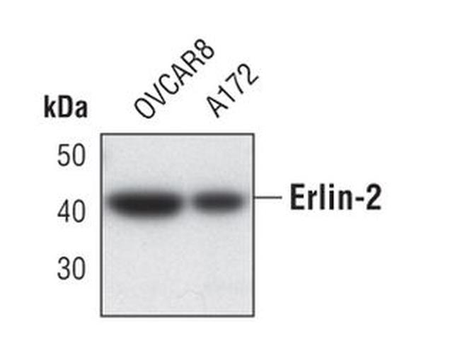 ERLIN2 Antibody in Western Blot (WB)