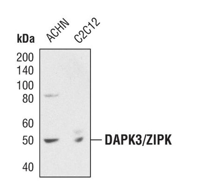 ZIPK Antibody in Western Blot (WB)