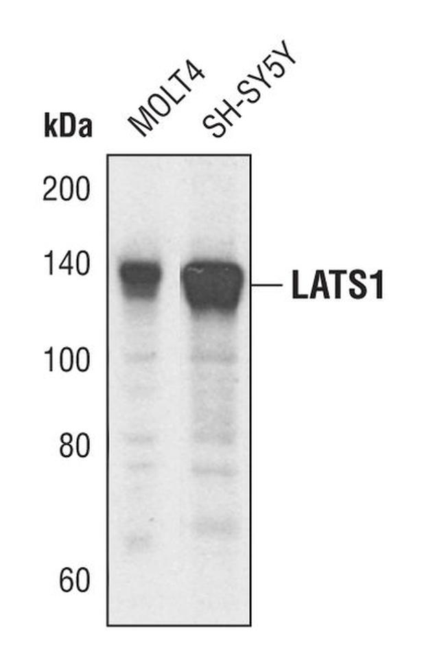 LATS1 Antibody in Western Blot (WB)