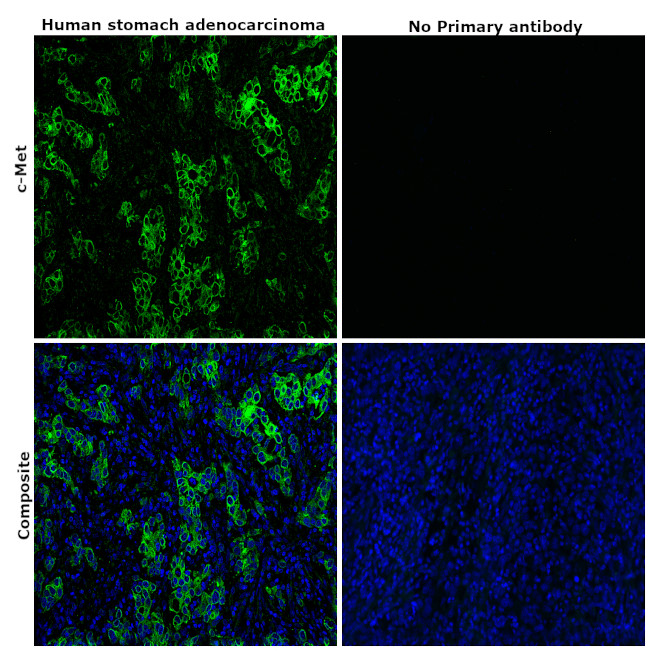 c-Met Antibody in Immunohistochemistry (Paraffin) (IHC (P))