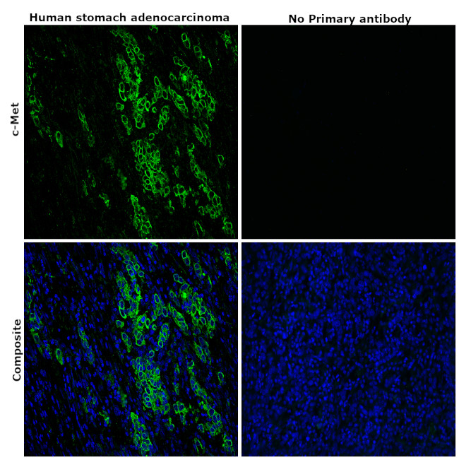 c-Met Antibody in Immunohistochemistry (Paraffin) (IHC (P))