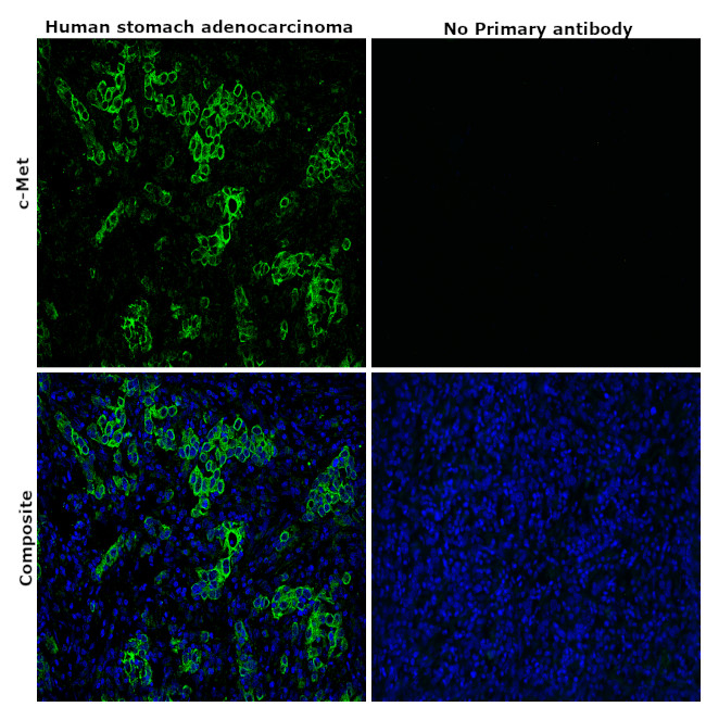 c-Met Antibody in Immunohistochemistry (Paraffin) (IHC (P))