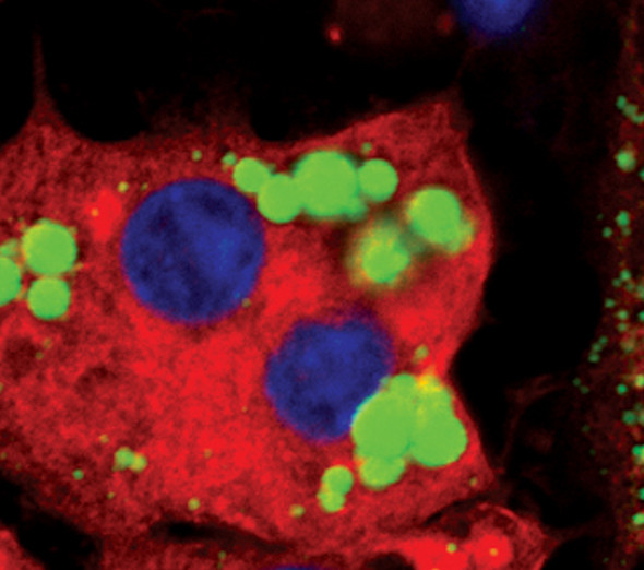 HSL Antibody in Immunocytochemistry (ICC/IF)