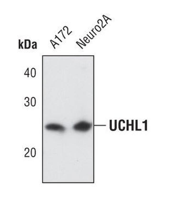 PGP9.5 Antibody in Western Blot (WB)