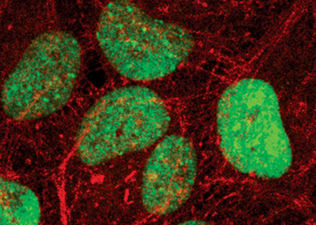 Phospho-HP1 gamma (Ser83) Antibody in Immunocytochemistry (ICC/IF)