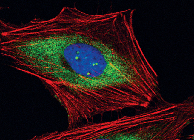 RPS3 Antibody in Immunocytochemistry (ICC/IF)