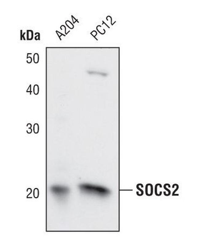 SOCS2 Antibody in Western Blot (WB)