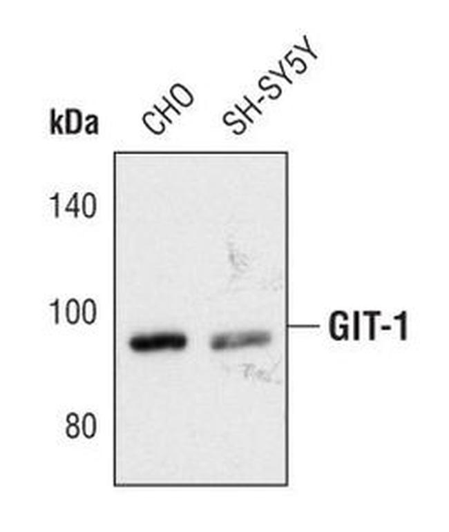 GIT1 Antibody in Western Blot (WB)