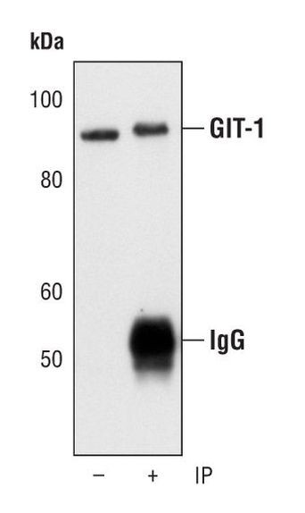 GIT1 Antibody in Immunoprecipitation (IP)