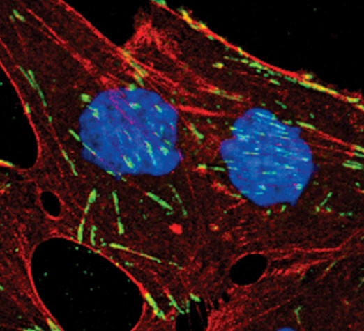 ITGB5 Antibody in Immunocytochemistry (ICC/IF)