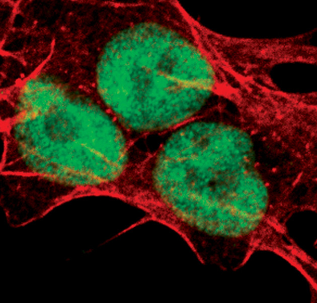 UBE1 Isoform A Antibody in Immunocytochemistry (ICC/IF)