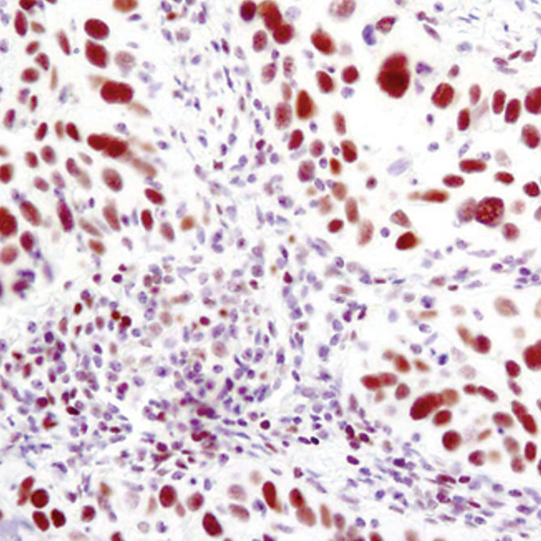 UBE1 Isoform A Antibody in Immunohistochemistry (Paraffin) (IHC (P))