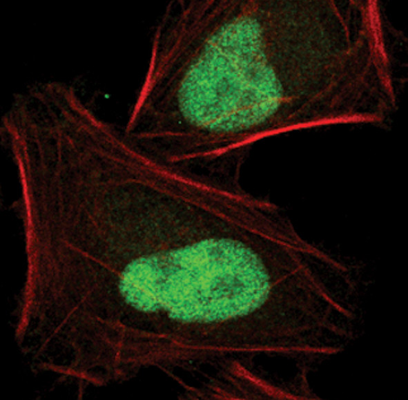 JunB Antibody in Immunocytochemistry (ICC/IF)