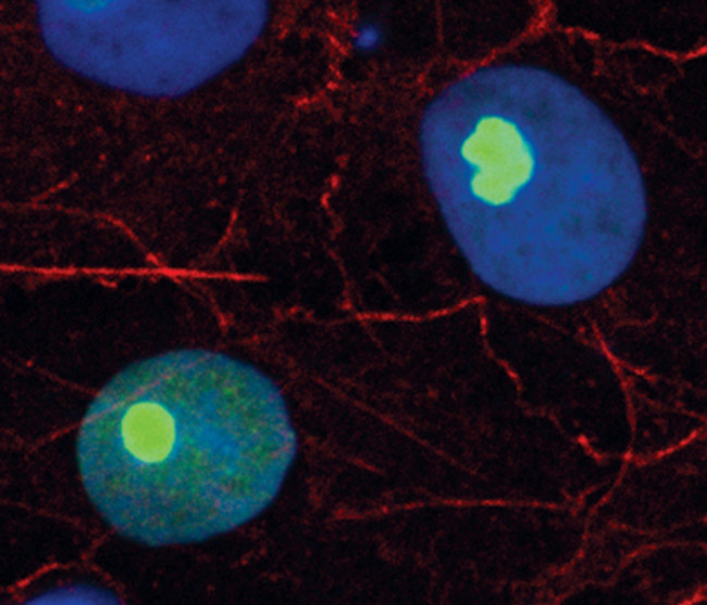 RPL7A Antibody in Immunocytochemistry (ICC/IF)