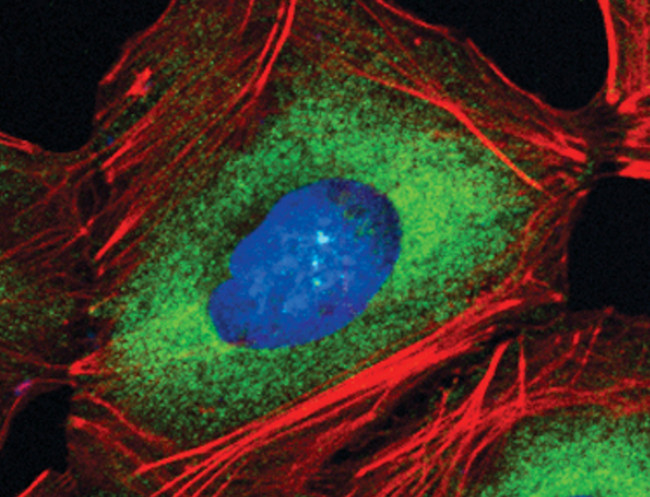 eIF4A1 Antibody in Immunocytochemistry (ICC/IF)