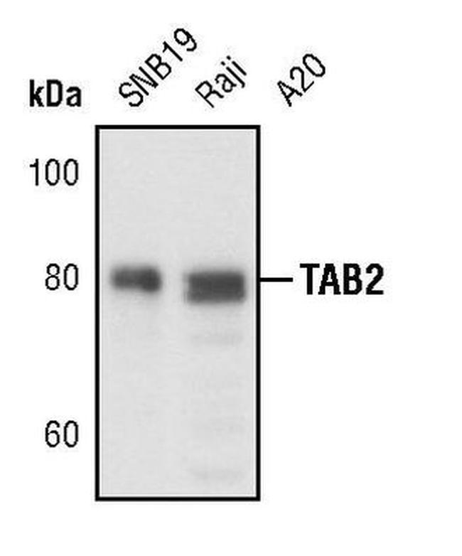 TAB2 Antibody in Western Blot (WB)