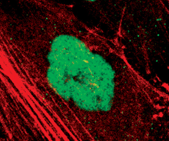 SETD7 Antibody in Immunocytochemistry (ICC/IF)