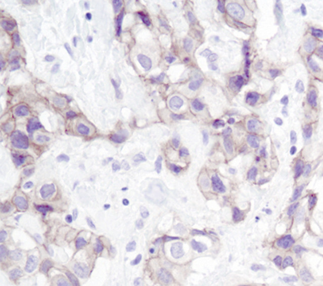 gamma Catenin Antibody in Immunohistochemistry (Paraffin) (IHC (P))