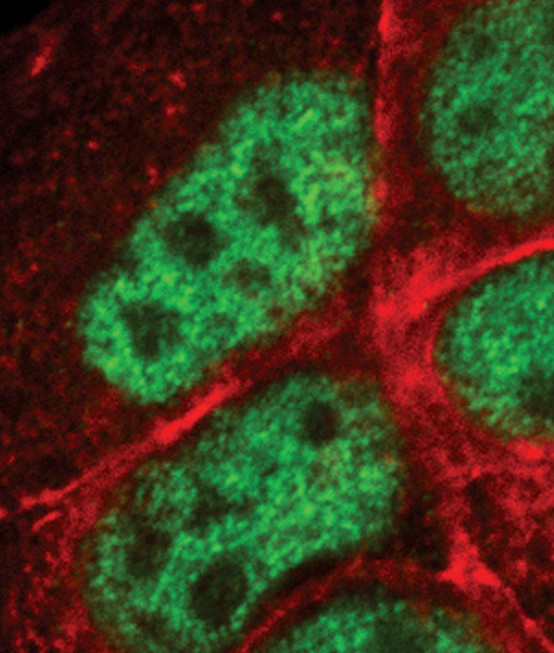 AP2 gamma Antibody in Immunocytochemistry (ICC/IF)