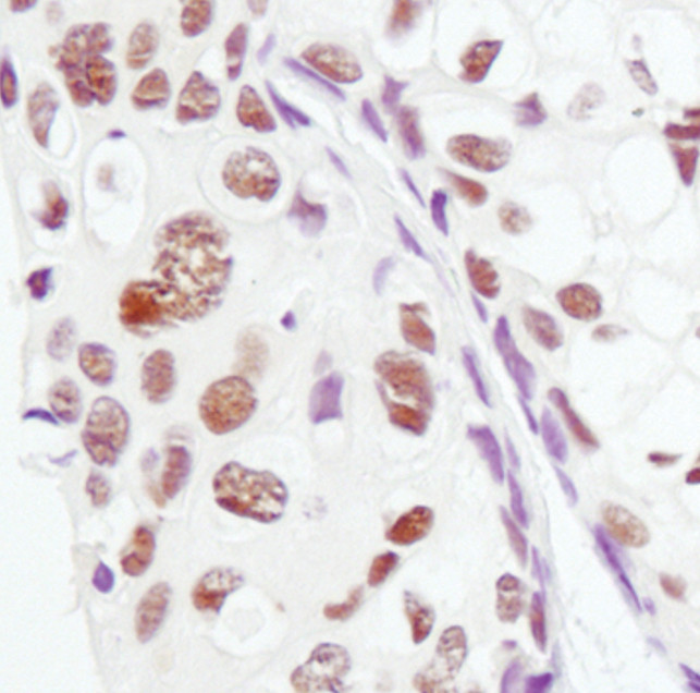 PSME3 Antibody in Immunohistochemistry (Paraffin) (IHC (P))