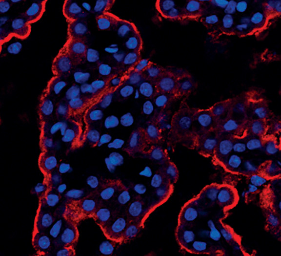 STK39 Antibody in Immunocytochemistry (ICC/IF)