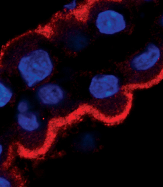 STK39 Antibody in Immunocytochemistry (ICC/IF)