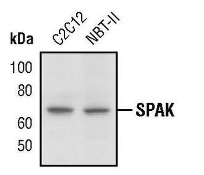 STK39 Antibody in Western Blot (WB)