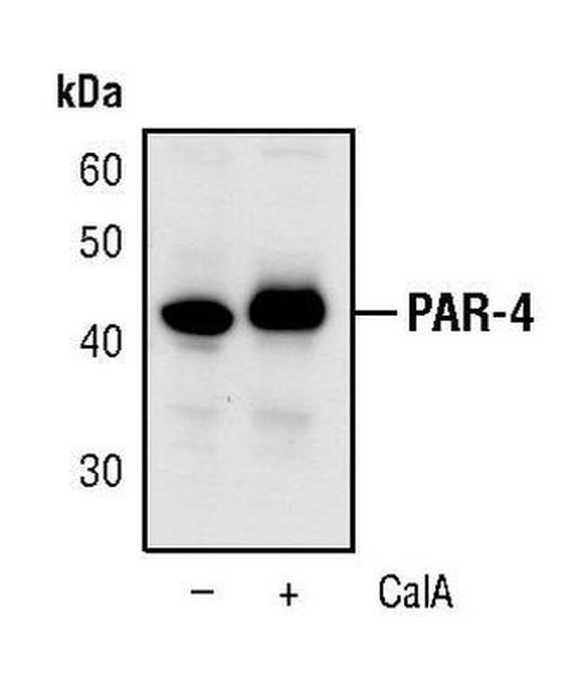 Phospho-PAR4 (Thr163) Antibody in Western Blot (WB)