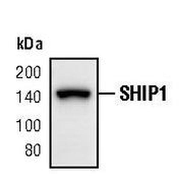 SHIP1 Antibody in Western Blot (WB)