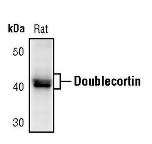 Doublecortin Antibody in Western Blot (WB)