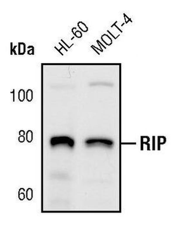 RIP1 Antibody in Western Blot (WB)