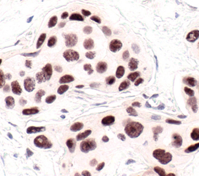 HP1 alpha Antibody in Immunohistochemistry (Paraffin) (IHC (P))