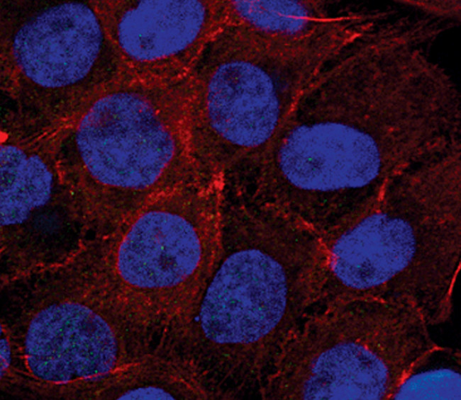 Catenin alpha-1 Antibody in Immunocytochemistry (ICC/IF)